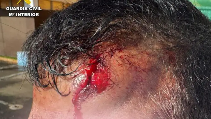 Wunde-Messerangriff-Corralejo